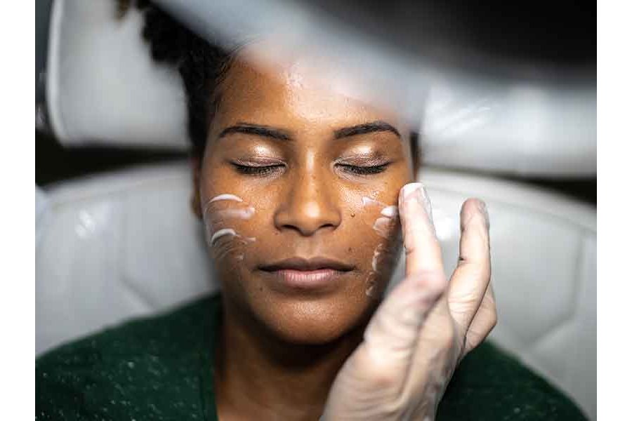 What No One Tells You About Chemical Peels For Black Skin