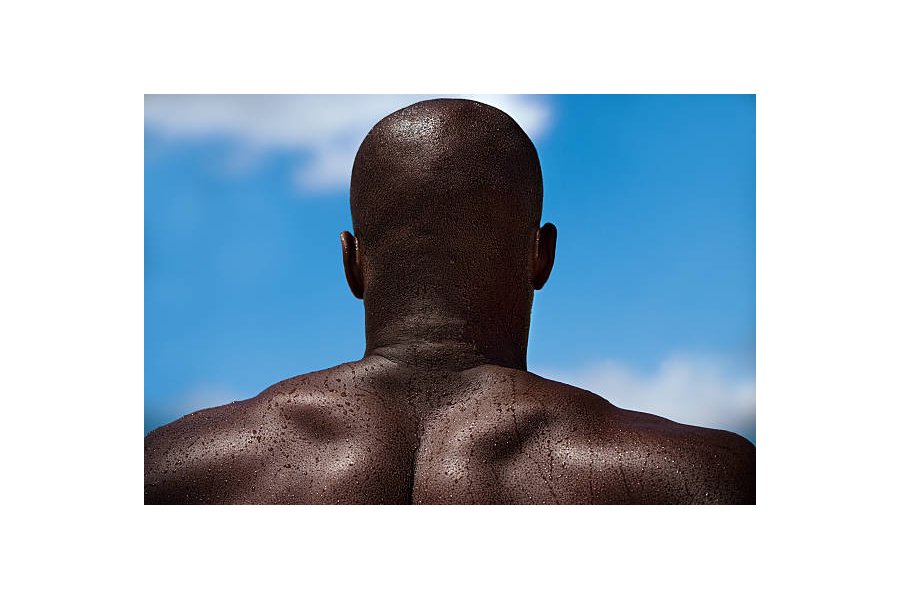 Bald men are warned not to visit Mozambique