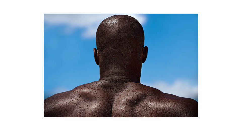 Bald men are warned not to visit Mozambique